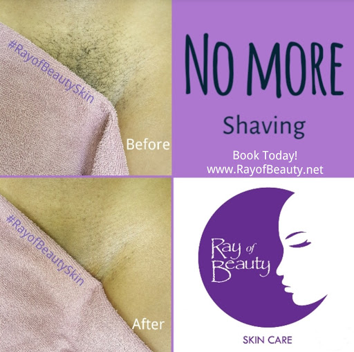 Ray of Beauty Skincare - Thumbnail