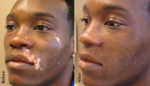 Photo n°11 de NoelleSkin à Nice (Tatoueur)