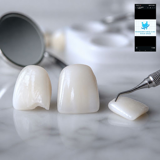 Wondering whether veneers or dental bonding is better to fix chipped or discolored front teeth? A…