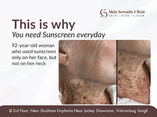 Essential for Face and Neck post image