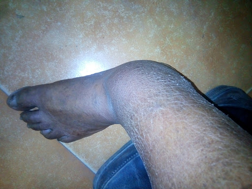 Cured within 5 weeks (Dr Soumya Dey's Clinic desk)  post image