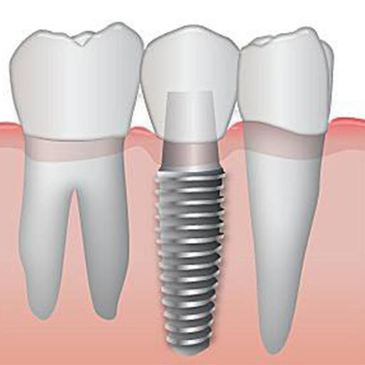 Gullo Dr. Angelo Dentista - Thumbnail