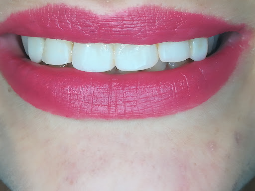 Dental Krysli
