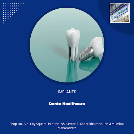 Transform your smile with high-quality implants from Dento Healthcare in Navi Mumbai. Enhance you… post image