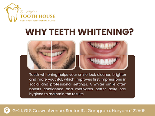 If you are searching for a dental clinic near me, Dr. Megha’s Tooth House in Sector 92 is a comfo…