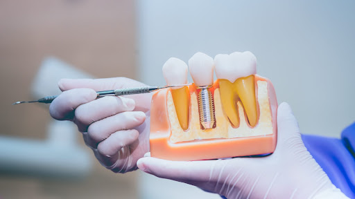Kingstowne Dental Care Gallery - United States