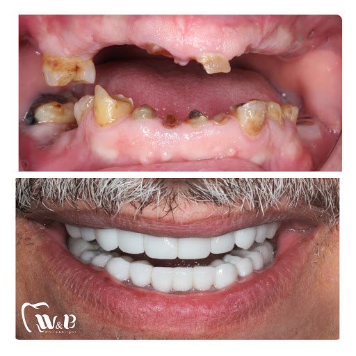 عيادة د.عمرو علاء الدين السباعي، طبيب أسنان بمستشفى مدينة نصر التخصصي - صورة 7