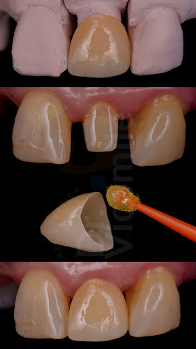 Opinii despre DR. VIC SMILE. - Odontología. în Quito - Dentista