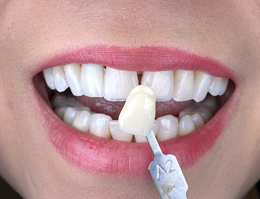 Smyrna Smiles Family Dentistry Gallery - United States