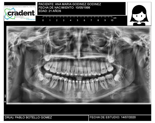 Cradent - Thumbnail