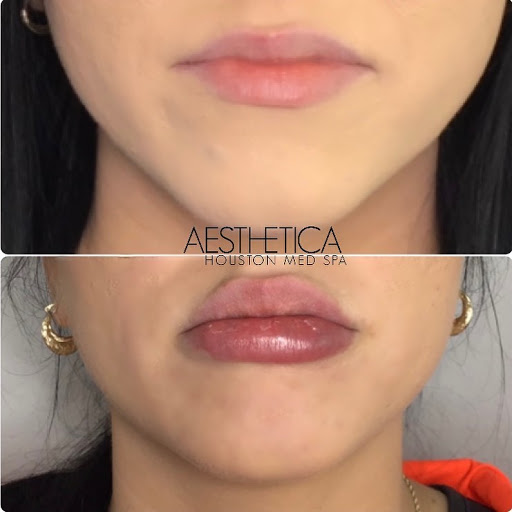Aesthetica Houston Med Spa - Thumbnail