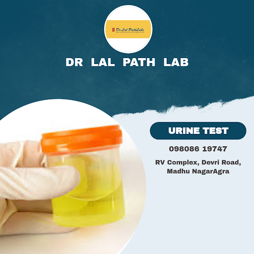 Urine Test post image