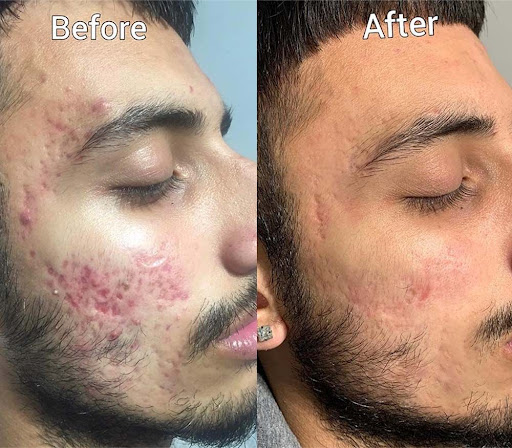 Best Cosmetologist In Mansarovar

#LUMINASKIN&AESTHETICCLINI