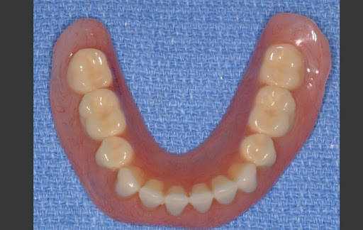 DentKits - Thumbnail