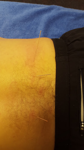 ASK Physio - Thumbnail