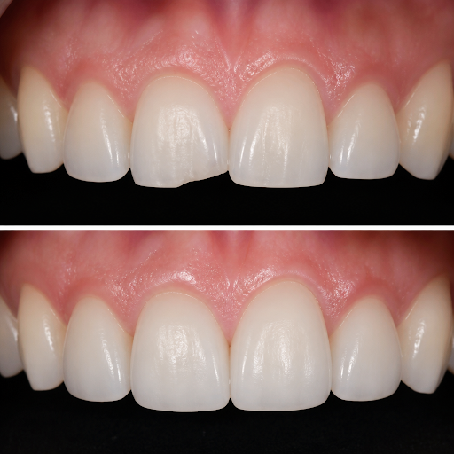 Small imperfections in your smile can make a big difference to your confidence. At Bahl Dental Cl… post image
