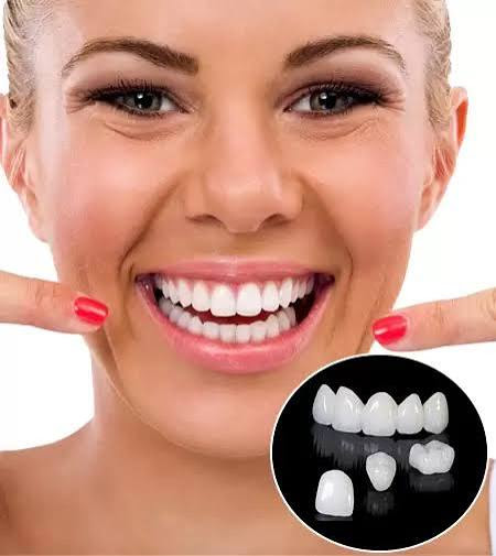 ​✨ Upgrade to a Flawless Smile: Metal-Free Crowns! ✨ post image