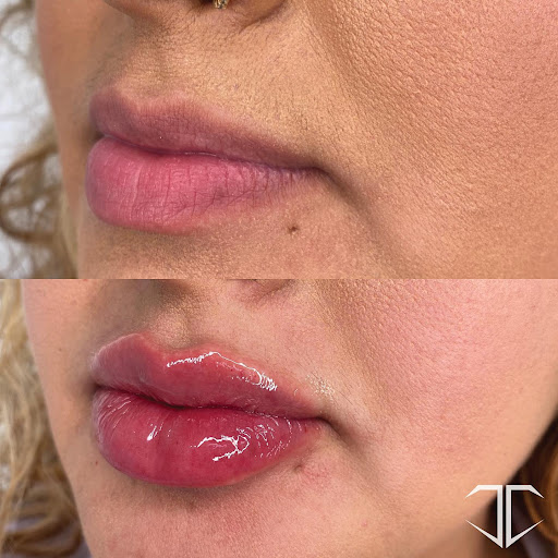 Charette Cosmetics Medical Spa - Atlanta