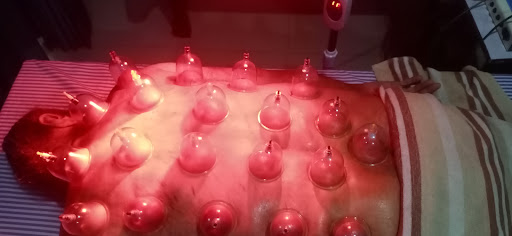 Cupping therapy for muscle stiffness release post image