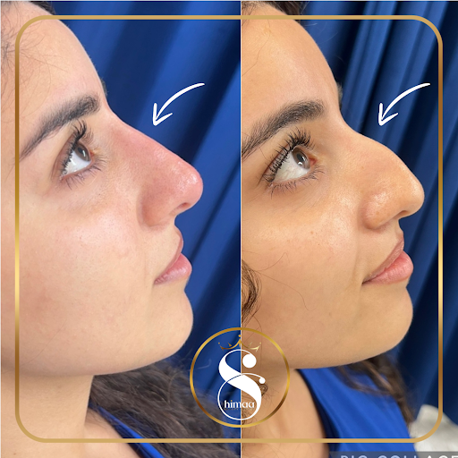Shimaa Beauty Center Arlington