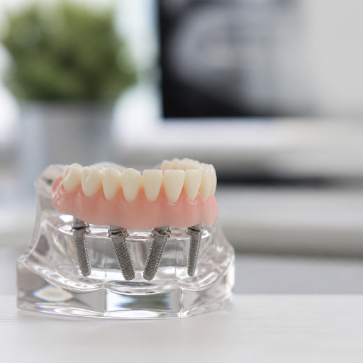 Struggling to chew comfortably because of missing or loose teeth? At Dr. Bhutada Dental Clinic in… post image