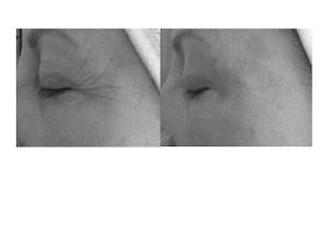 Photo n°22 de Model'corps à Bons-en-Chablais (Centre d'amincissement)