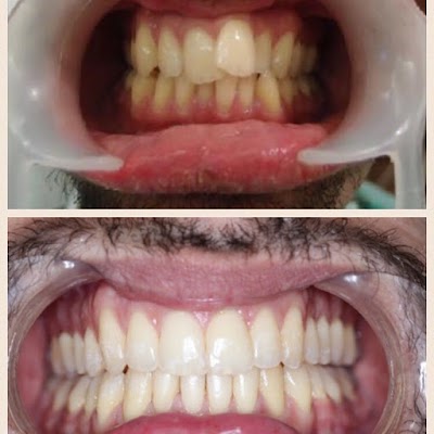 Photos of Dr.George Bardawil - Orthodontist - Invisalign diamond Provider