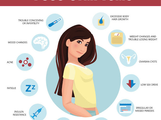 Polycystic ovary syndrome (PCOS) is a condition in which the ovaries produce an abnormal amount o… post image