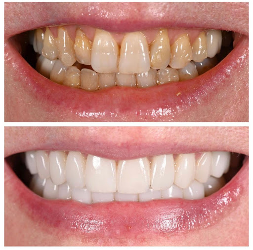 Minot Dental Partners