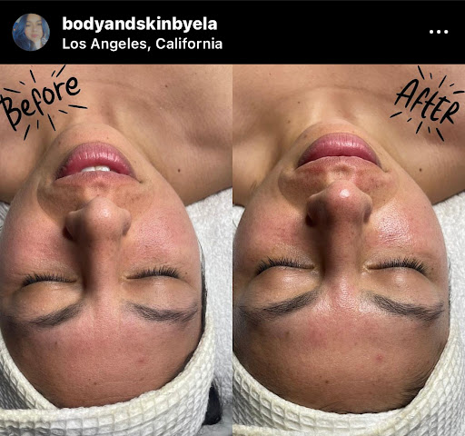 Body and Skin by Ela - Thumbnail