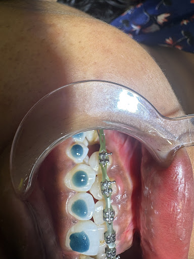 Dr Rajneeyadav ( BDS,MDS- specialist dental surgeon) post image