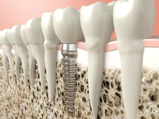 Lameh's Denture Center - Thumbnail