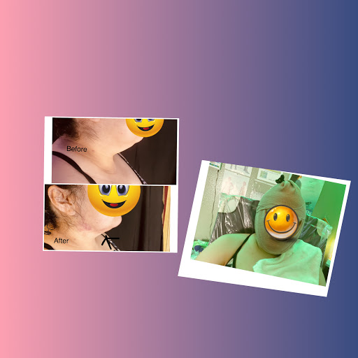The Healing Place by Jrenee' - Body Sculpting & Contouring, IV Hydration - Thumbnail