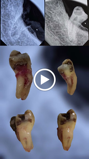 Dura Dental Center - Nasr City - صورة 5