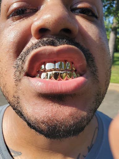 Custom Grillz Fl - Thumbnail