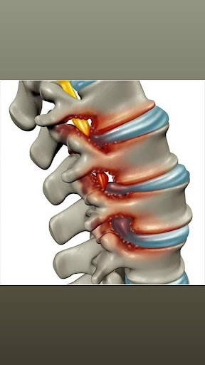 Spine & joint offers comprehensive nonoperative treatment for those individuals with back or neck… post image