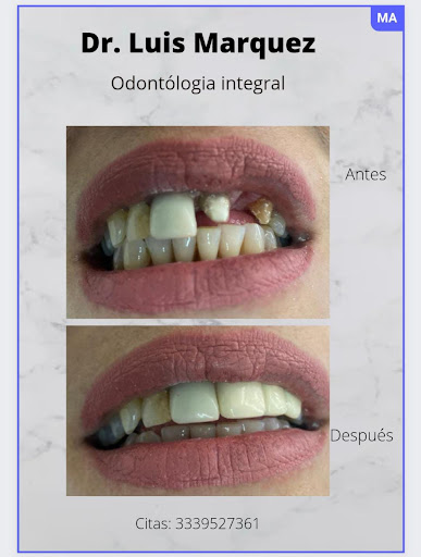 Clínica dental jalisciense (parques del castillo) - Thumbnail