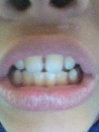 Photos of Himal Dental Hospital & Institute of Dental Science