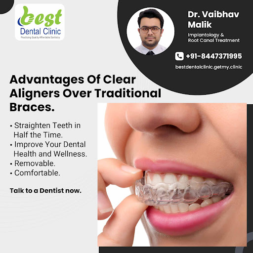 Orthodontic treatment might sound complicated, but it is the act of moving or straightening teeth… post image