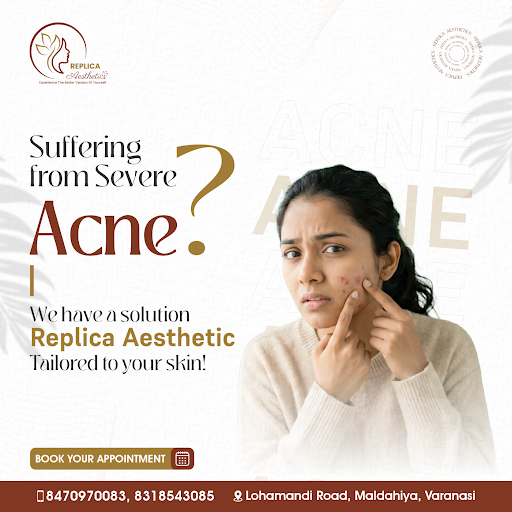 ✨ Struggling with Severe Acne? We Have the Solution! | Replica Aesthetic ✨ post image