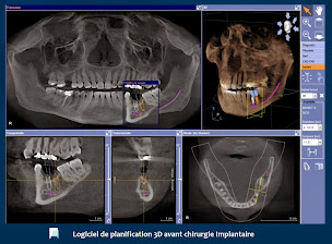 Photo n°11 de Dr FAUCHARD Pierre à Paris (Parodontiste spécialiste des implants dentaires)