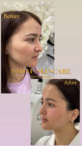 Sadaf Skin Care Mawson Lakes - Thumbnail