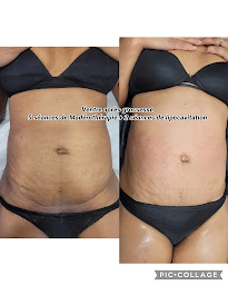 Photo n°17 de Naïs Beauté à Montgeron (Centre de bien-être)