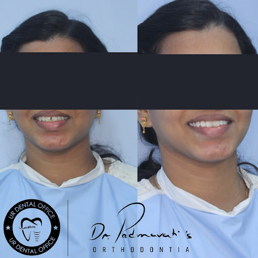 Welcome to UR Dental Office - Dr. Padmavati's Orthodontia, the top choice for dental care in Vela… post image