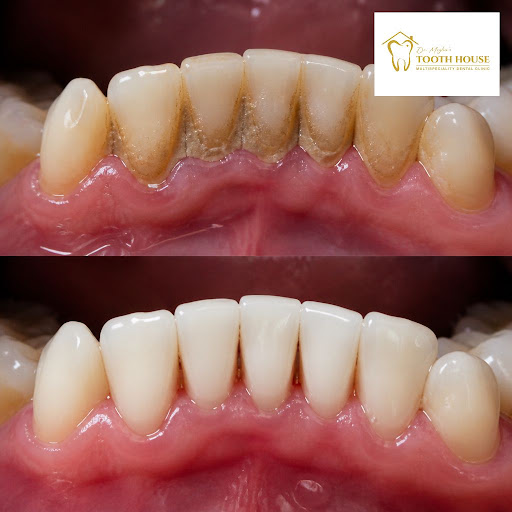 Healthy gums and stain-free teeth do more than improve your look – they protect your overall oral… post image