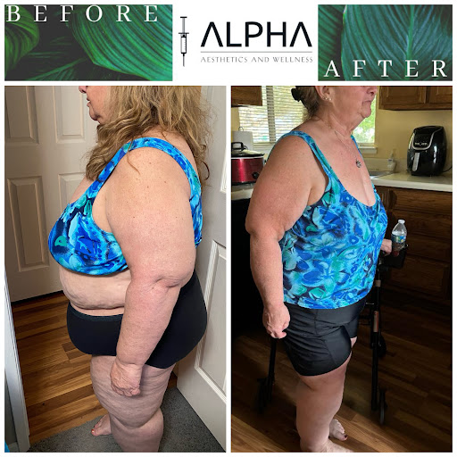 Alpha Aesthetics and Wellness