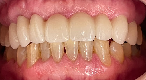 Dentista Alexa Patlán - Consultorio Dental