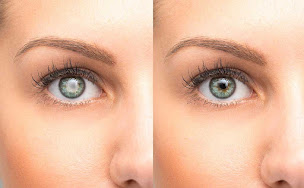 Photo n°7 de DE MONTLEAU Isabelle à Montigny-le-Bretonneux (Ophtalmologiste pédiatrique)