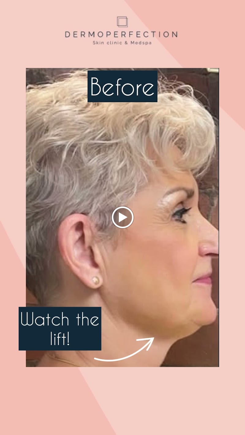 Dermoperfection Medical Skin & Aesthetics Clinic at the Mailbox photo 3