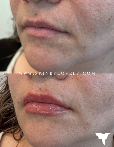 Skin by Lovely Camas